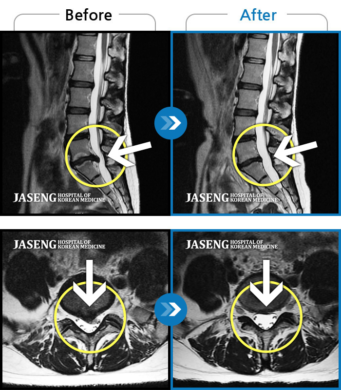 ڻѹ溴 ġ MRI  ġ-ɾ ִٰ Ͼ   մϴ.  ̺ ߱ ϴ.