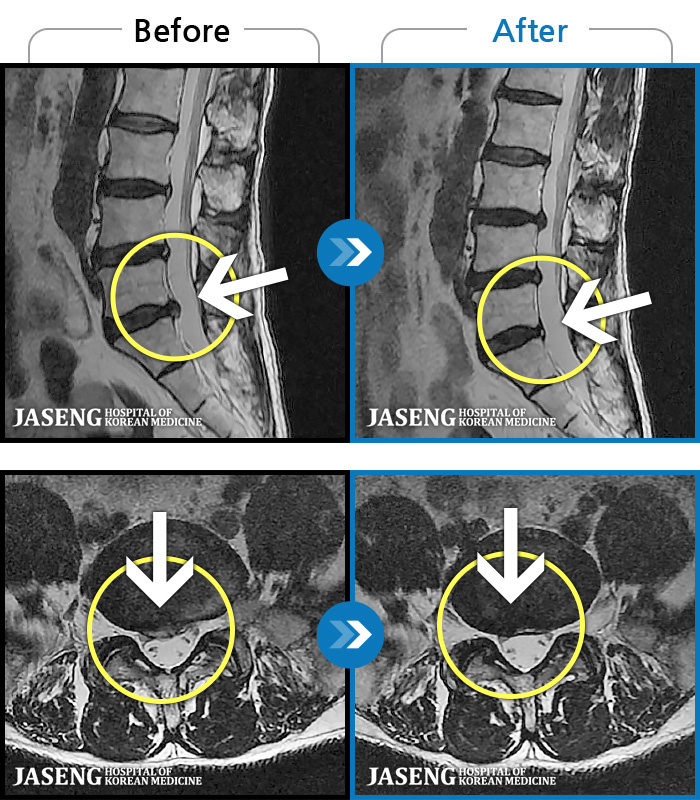 ϻڻѹ溴 ġ MRI ġ- ϰ ӵǾϴ. ߰ Ͽ ߰ Ǵ ߵ ̻ ȣϴ ¿ϴ.