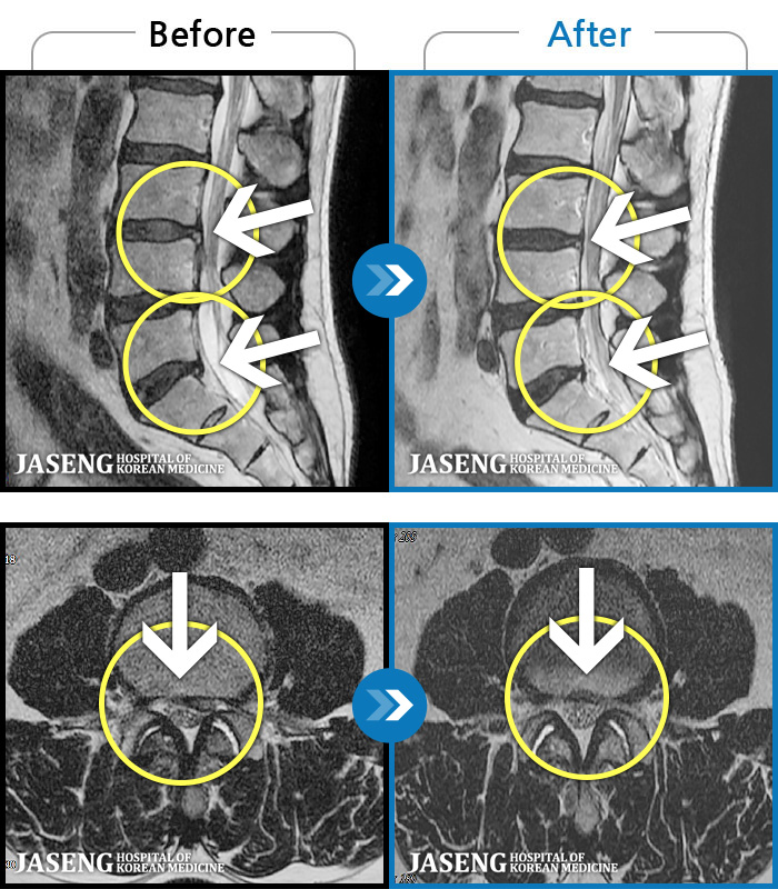õڻѹ溴 ġ MRI  ġ- 㸮     Ͽ ȴ ͵  · ϼ̽ϴ. 
