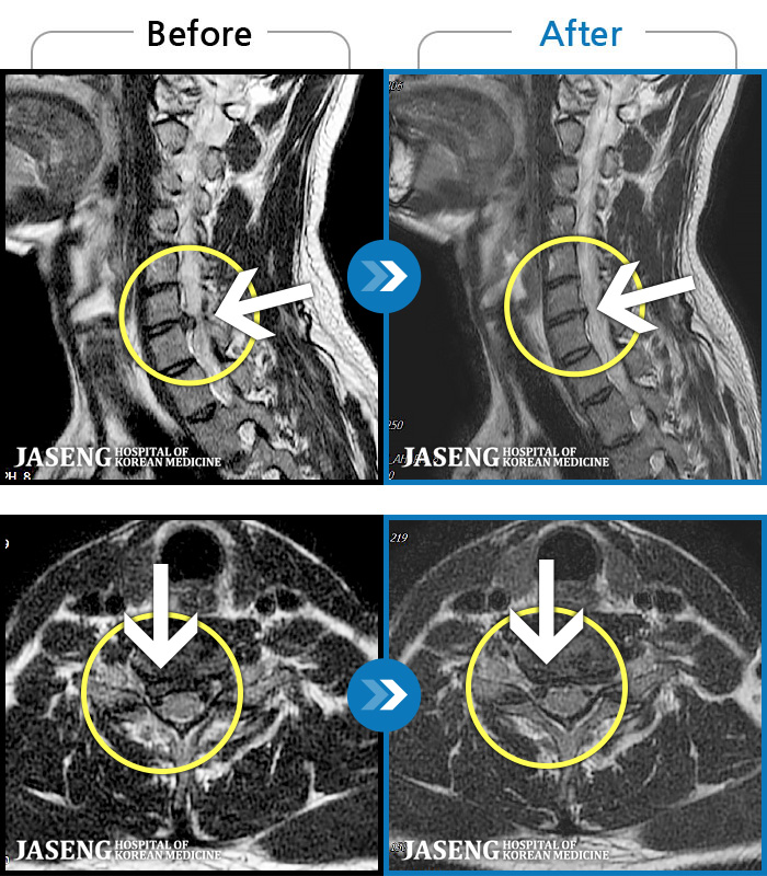 õڻѹ溴 ġ MRI  ġ- Ͽϴ.