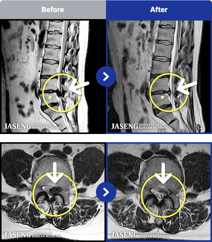 �ڻ��ѹ溴�� ġ���� MRI�� ���� ġ����-�㸮 ������ ���� �кκ��� �����, �߸� ���� ������ �������� �����ϼ̽��ϴ�.