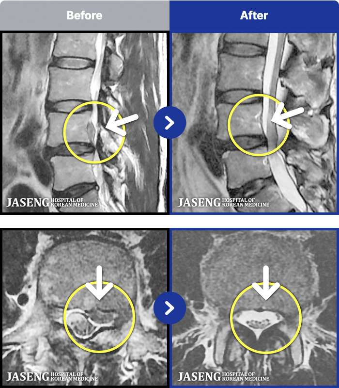 ڻѹ溴 ġ MRI ġ- Ͽ ü Ÿ Ͽϴ.